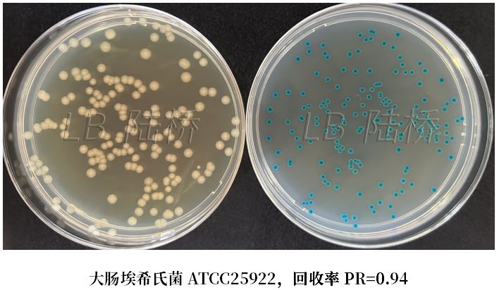 GB 4789.38-2025《食品安全國家標準 食品微生物學(xué)檢驗 大腸埃希氏菌計數》解讀 GB 4789.38-2025《食品安全國家標準 食品微生物學(xué)檢驗 大腸埃希氏菌計數》解讀