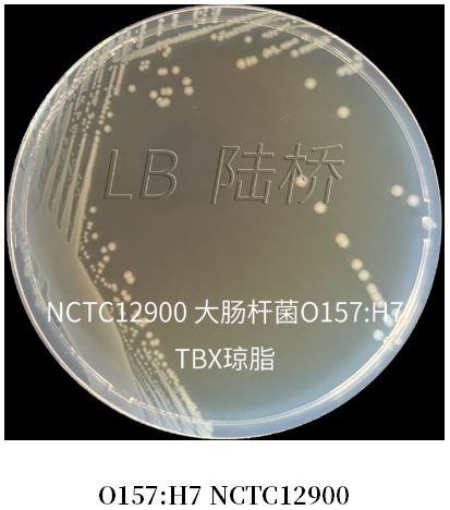 GB 4789.38-2025《食品安全國家標準 食品微生物學(xué)檢驗 大腸埃希氏菌計數》解讀 GB 4789.38-2025《食品安全國家標準 食品微生物學(xué)檢驗 大腸埃希氏菌計數》解讀